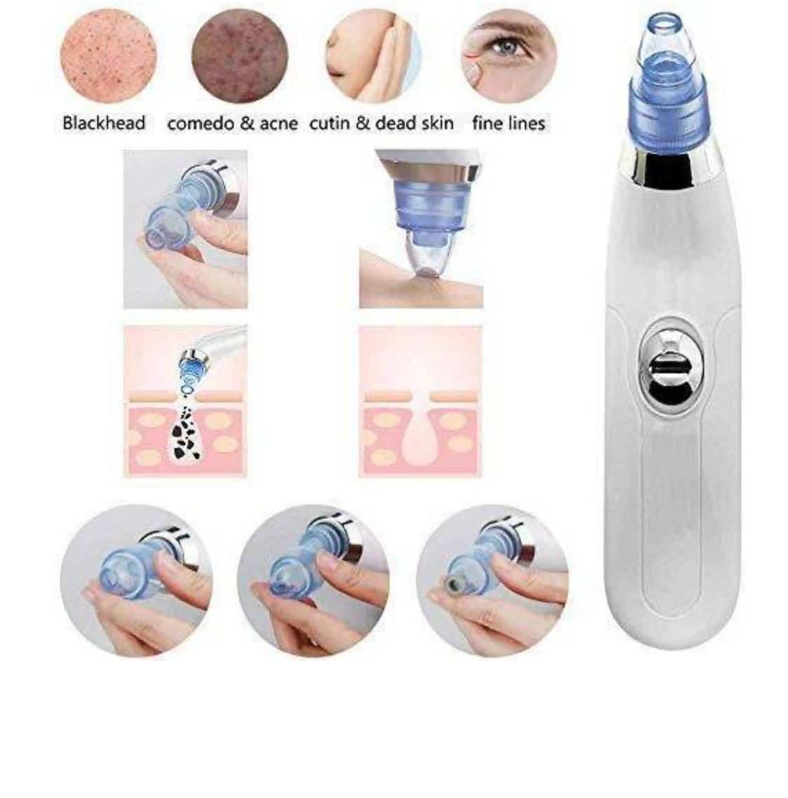 Blackhead Removal Machine | Derma Suction 3 In 1 Black Head Remover Machine | Acne Pimple Pore Cleaner Vacuum Suction Tool