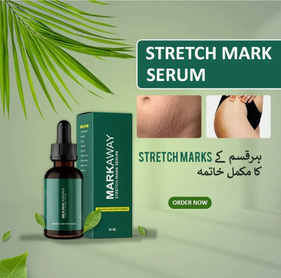 Markaway Stretch Mark Serum 30ml | Herbal Formula for Scars & Skin Elasticity